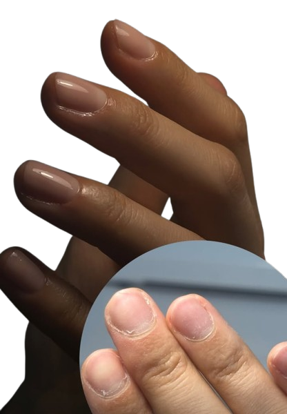 Schritt für Schritt